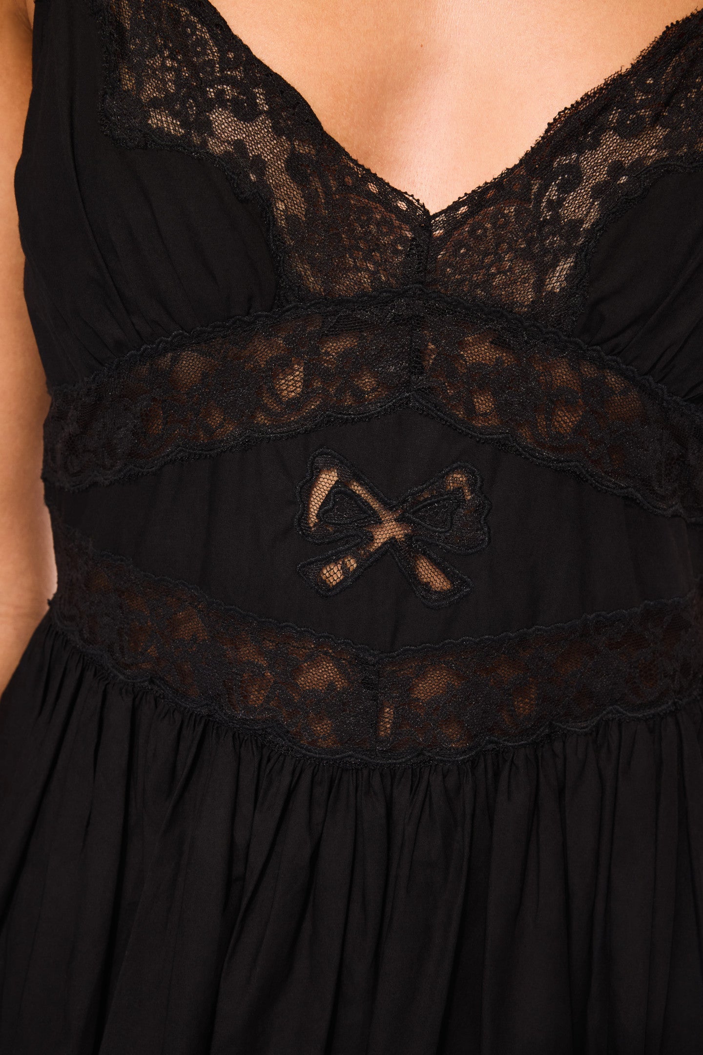 Zima Cotton Lace Bow Mini Dress